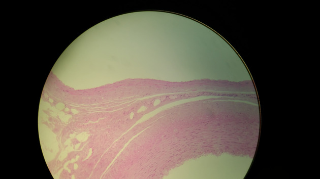 Artery and Vein Slides - Artery and Vein 006 100X